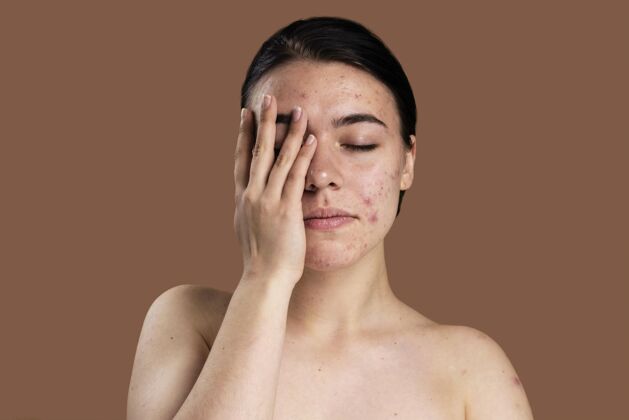 面部年轻女子对自己的粉刺充满自信的画像油性皮肤问题面部