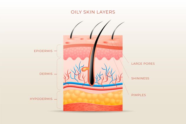 现实真实的油性皮肤层插图皮肤层次油性皮肤